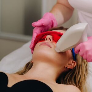 Лазерная эпиляция: верхняя губа