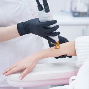 Лазерная эпиляция: предплечия