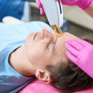 Лазерная эпиляция: лицо полностью (муж)