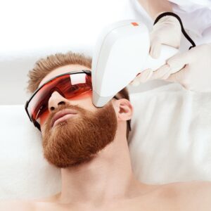 Лазерная эпиляция: борода (муж)